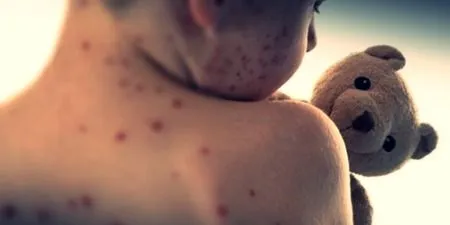 Mongolia'stotalnumberofconfirmed