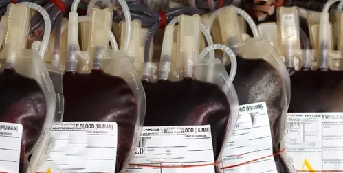 पश्चिम बंगाल के सरकारी अस्पताल में खून की कालाबाजारी का आरोप, तीन लैब सहायक गिरफ्तार