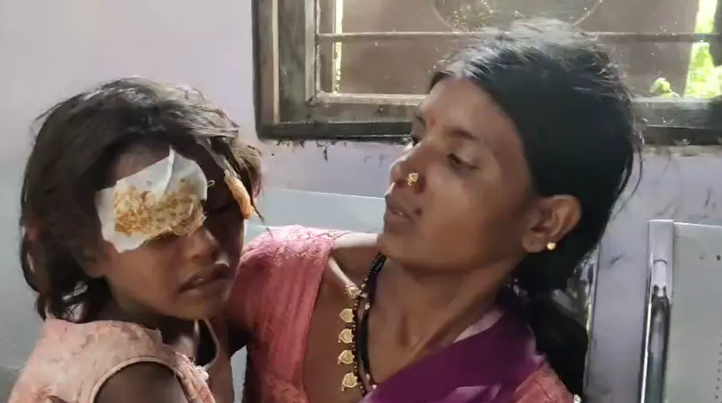 नाना के घर आई बच्ची पर सियार ने किया हमला: मां ने पत्थर मारकर बचाई जान, 6 वर्षीय मासूम की हालत गंभीर