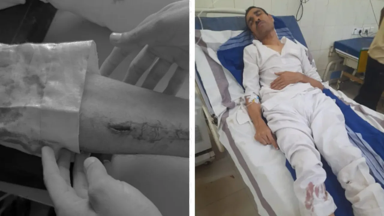 दिनदहाड़े घेरकर लाठी-डंडों व फरसा से किया लहूलुहान, मंदिर से घर लौटते समय रास्ते में की गई मारपीट