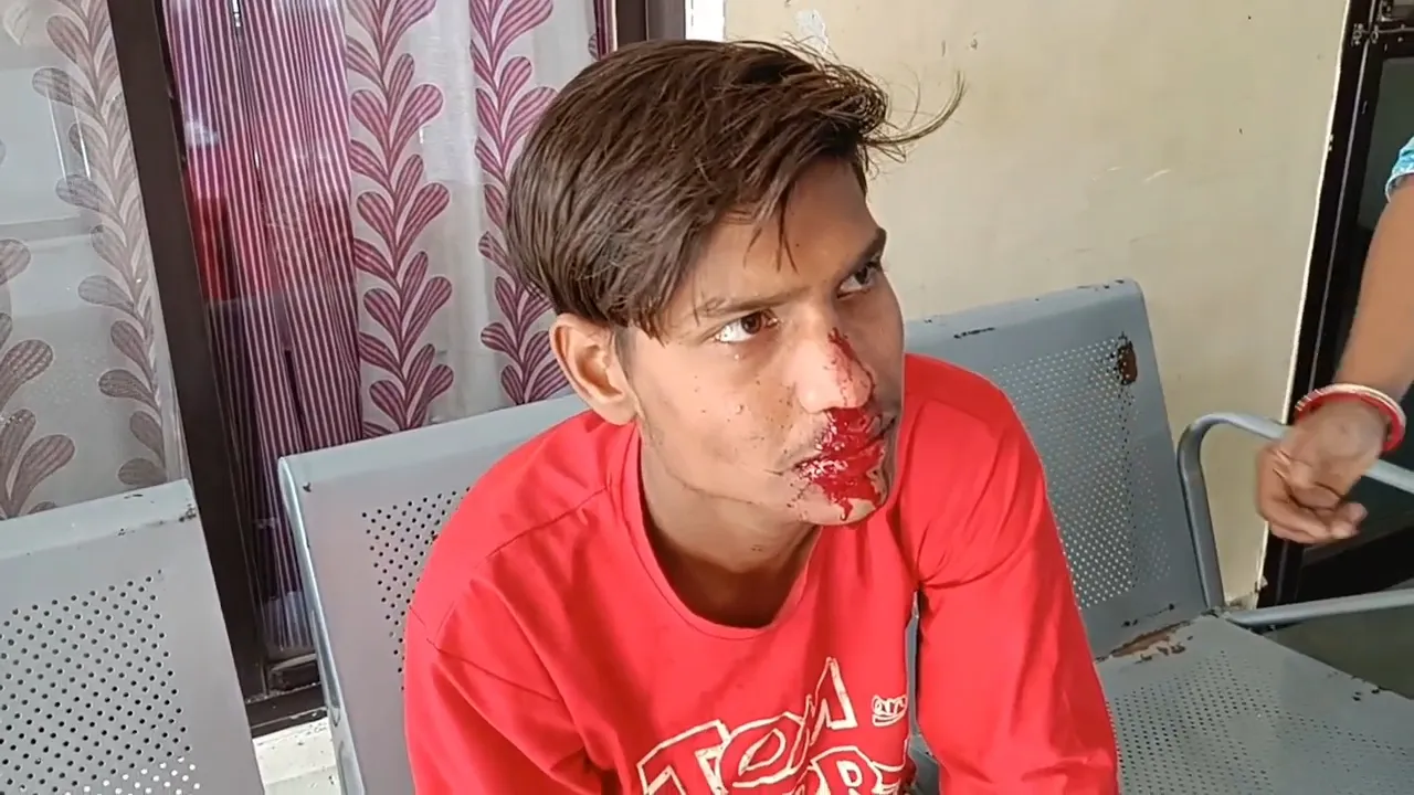 गाली-गलौज के बाद पीटा, नाक और पीठ में आईं चोटें; बीच-बचाव में आए लोग